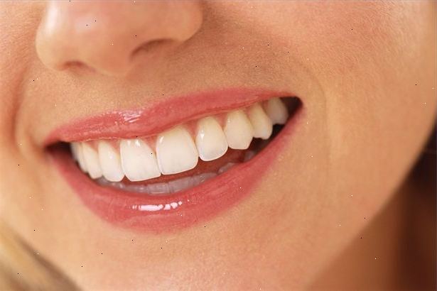 Hoe om tanden whitening gel te gebruiken. Koop een teeth whitening gel.