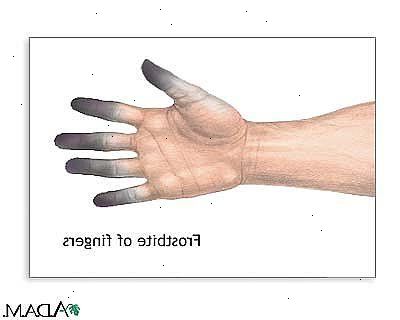 Tintelende vingers ongemak veroorzaken. Mogelijk moet u uw arts raadplegen als je je voelt tintelingen gevoel.