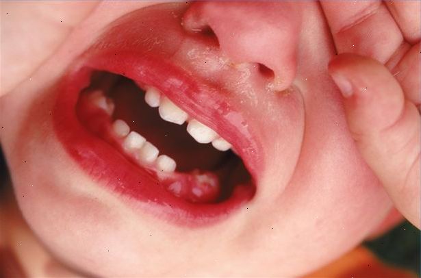 Voor baby&#39;s die meer tanden. Dit zijn de eenvoudige stappen over hoe u kunt poets je kind tanden.