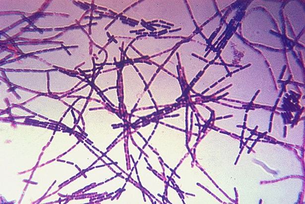 Anthrax is een infectieziekte die wordt veroorzaakt door bacillus anthracis.