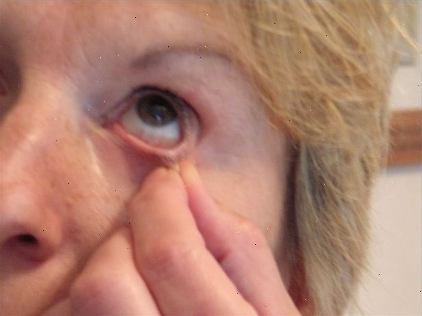 Hoe kan ik oogdruppels toe te passen. Voor de behandeling van een aantal oogaandoeningen, zoals droge ogen.