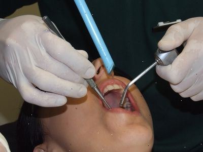 Hoe te plannen voor cosmetische tandheelkundige zorg. Veneers laminaat de tanden.