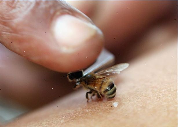 Hoe maak je een bijensteek of wespensteek te behandelen. Genees deze steken op een natuurlijke manier!