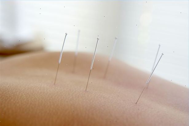 Hoe kan acupunctuur therapie te begrijpen