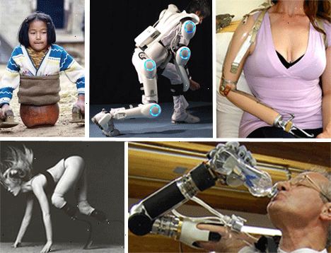 Hoe maak je een prothese been monteren. Bevestig de ontgrendelingsknop.