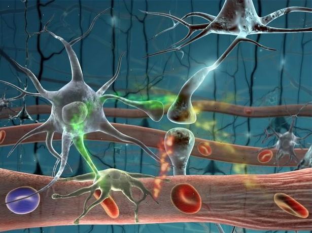 Hoe u veelvoorkomende neurologische aandoeningen te identificeren. Stroke - een beroerte gebeurt wanneer het bloed gaan door de hersenen is direct gestopt.